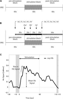 Vagus Nerve Stimulation Amplifies Task-Induced Cerebral Blood Flow Increase